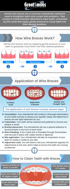 Dental Insurance With Orthodontic Coverage: Smile Confidently
